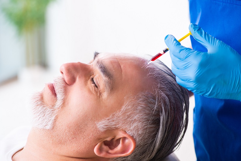 Behandlungen von Haarausfall bei Männern